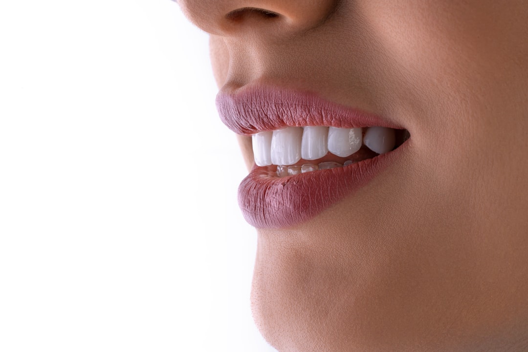 How Long Will My Gums Need to Heal After Extractions Before Getting Dentures?